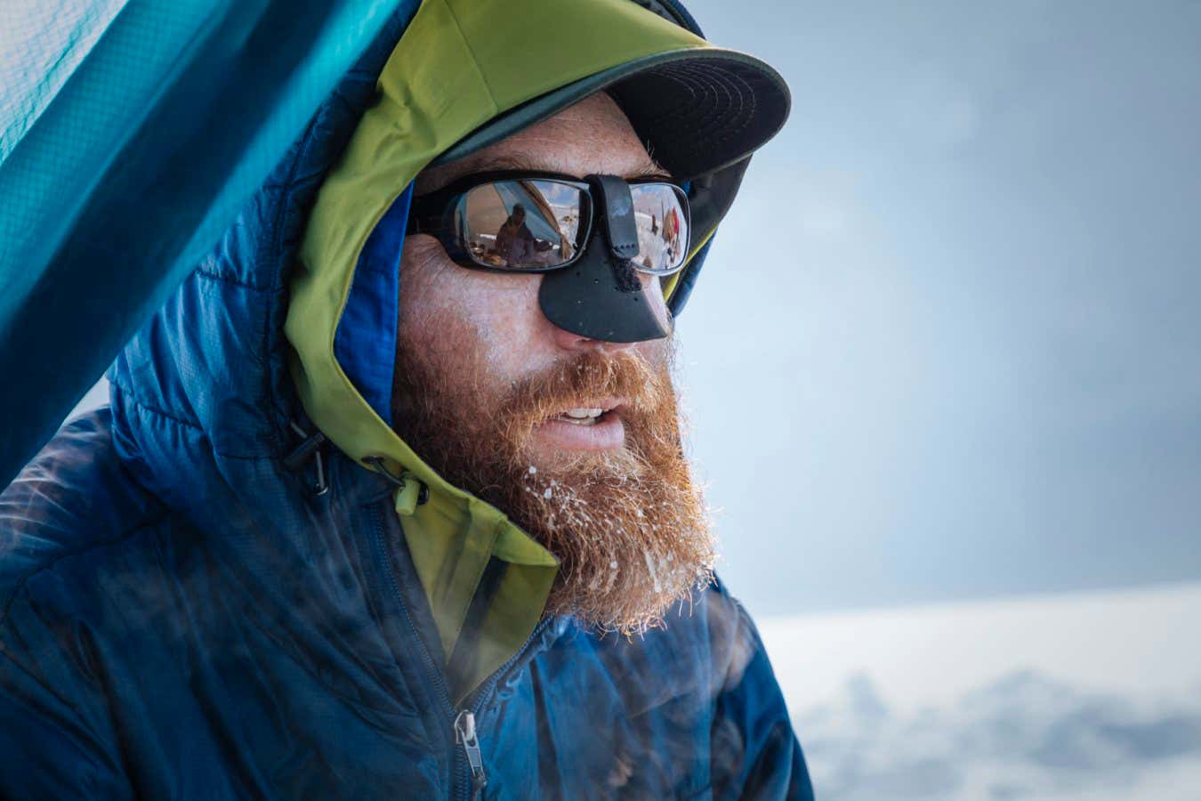 A probiotic cream could make visits to extremely cold environments a little bit saferAurora Photo...