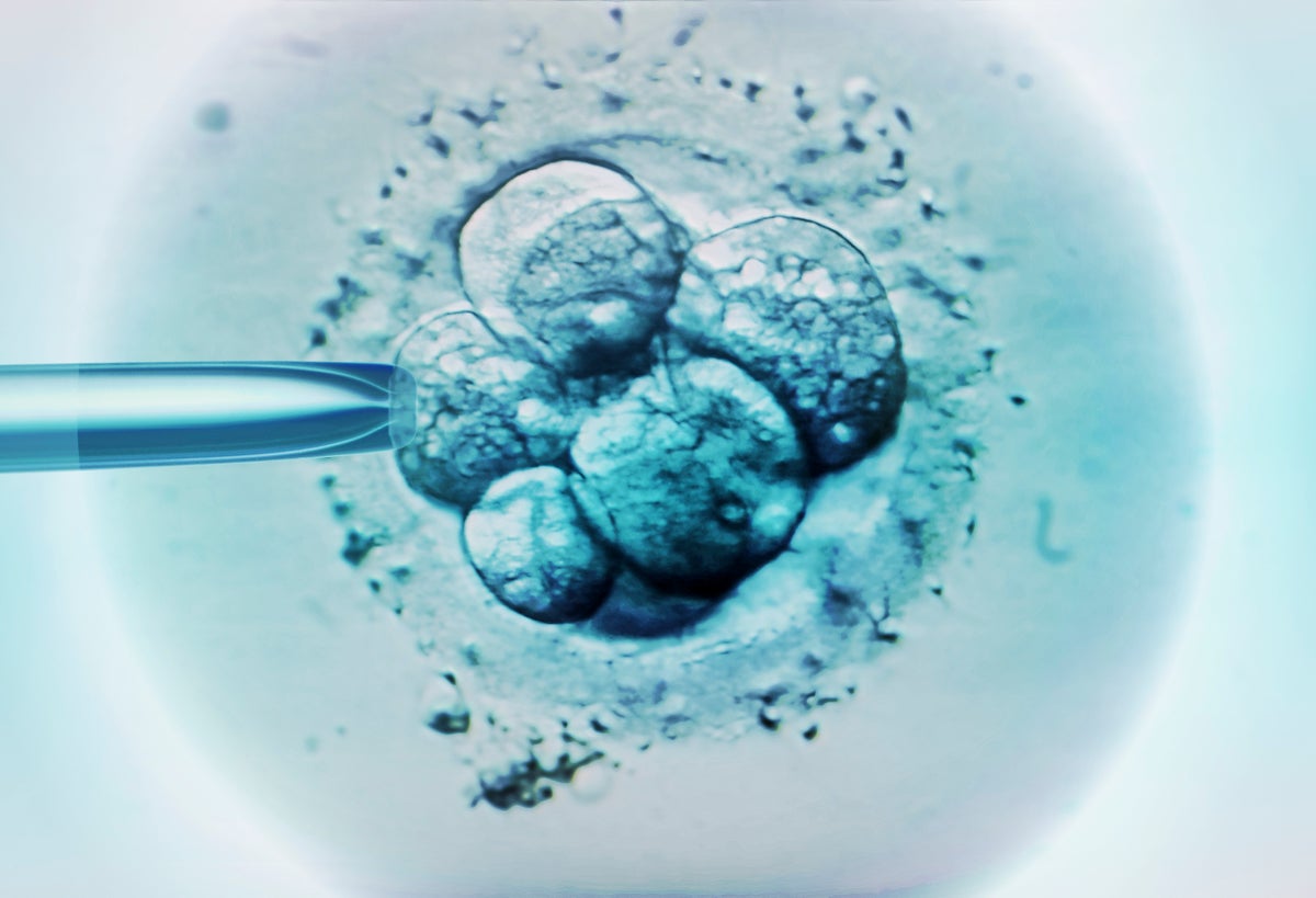 Embryos Science Photo Library–ZEPHYR/Getty Images