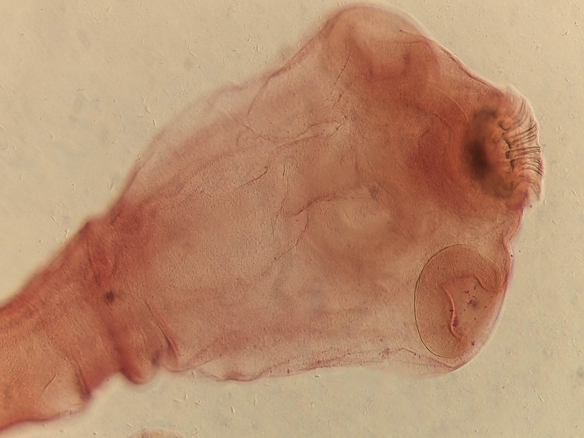 Taenia-solium Taenia solium Mohammed Al Ali via Getty Images