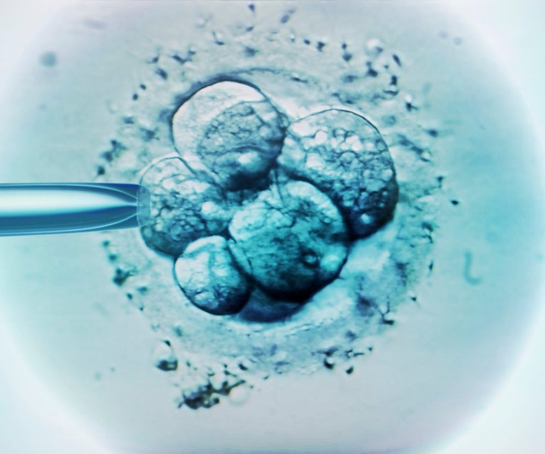 Science Photo Library–ZEPHYR/Getty Images