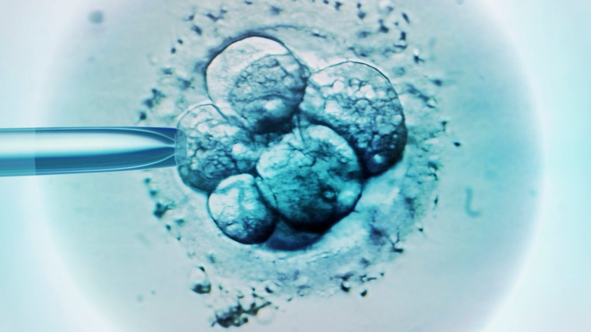 Science Photo Library–ZEPHYR/Getty Images