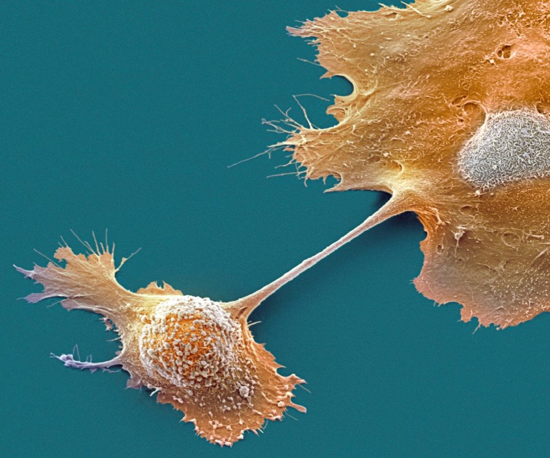 Science Photo Library–STEVE GSCHMEISSNER/Getty Images