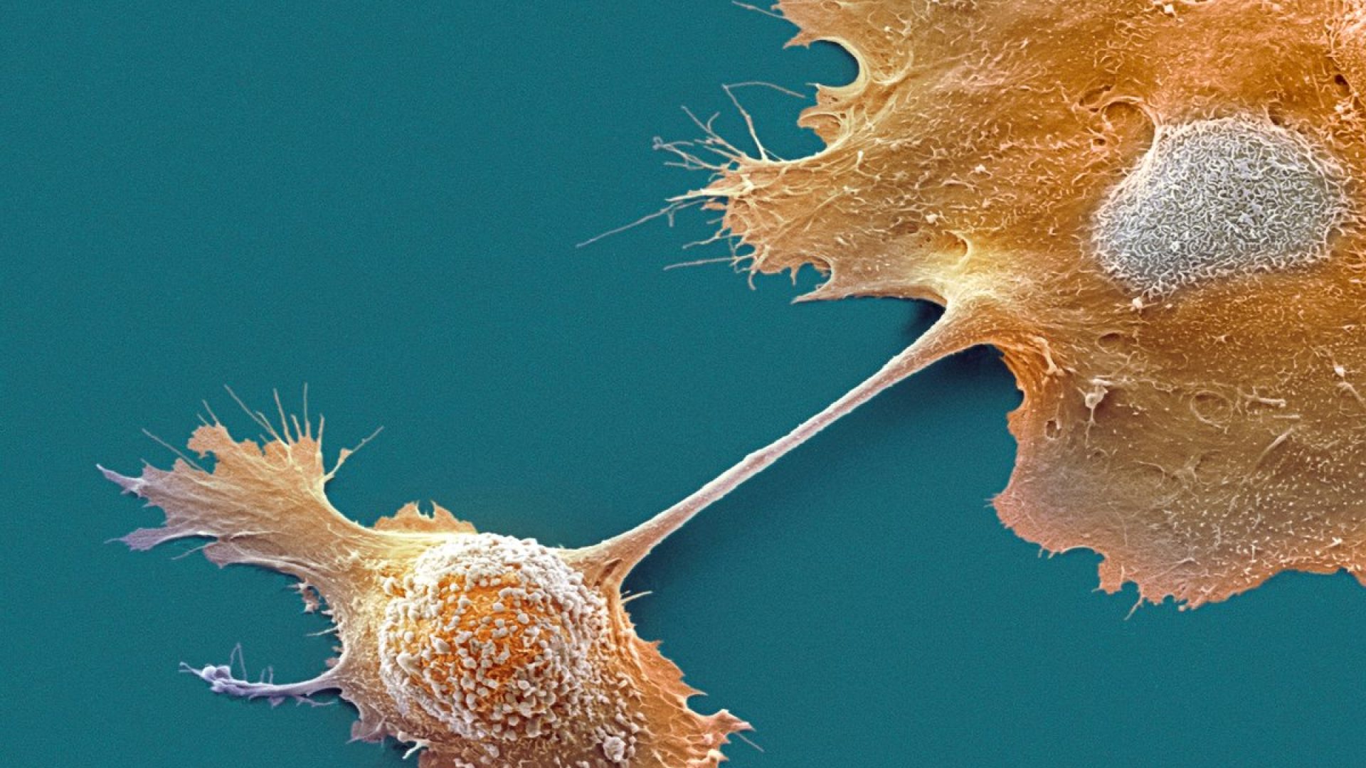 Science Photo Library–STEVE GSCHMEISSNER/Getty Images