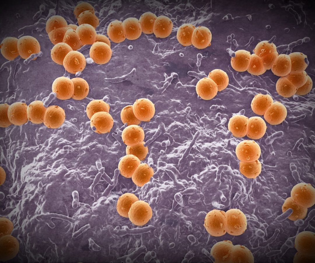 Illustration of the bacteria Neisseria meningitidis. ROGER HARRIS/SCIENCE PHOTO LIBRARY/Getty Images