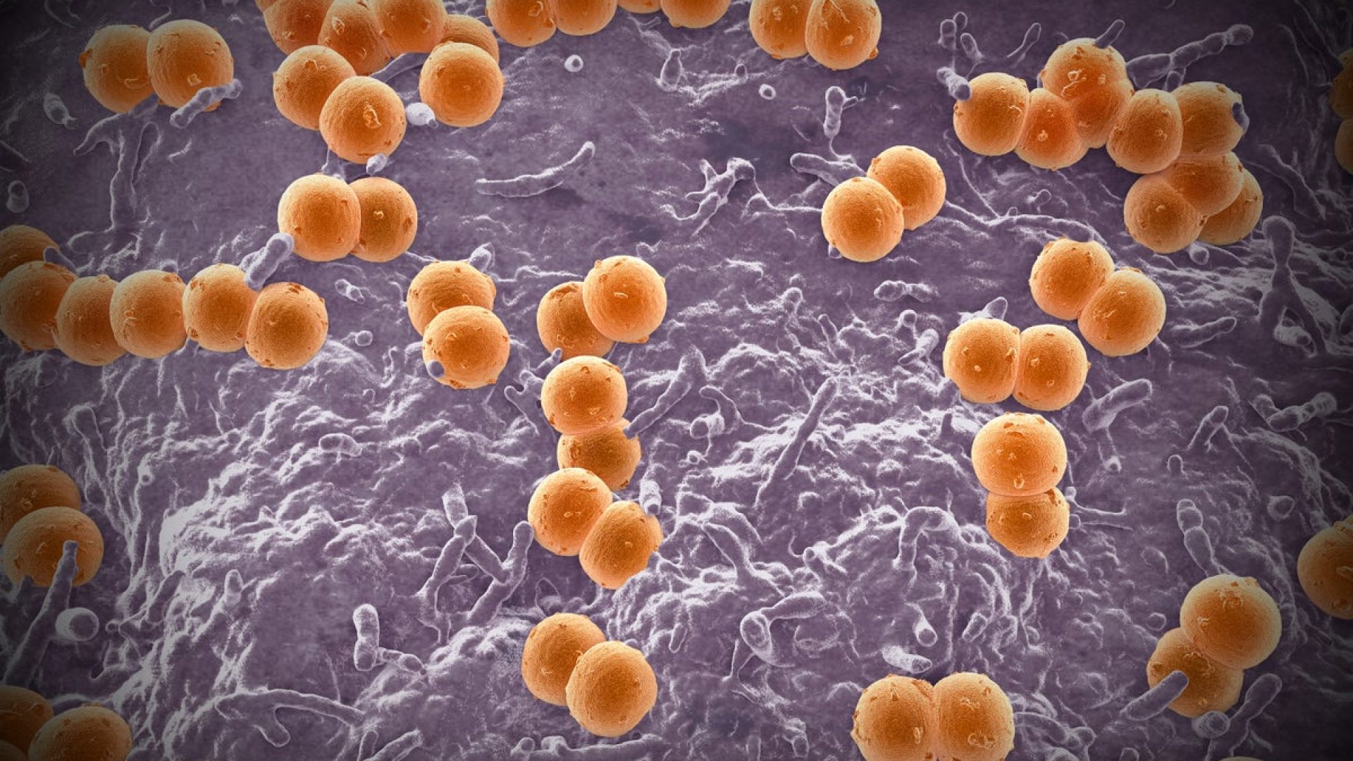 Illustration of the bacteria Neisseria meningitidis. ROGER HARRIS/SCIENCE PHOTO LIBRARY/Getty Images