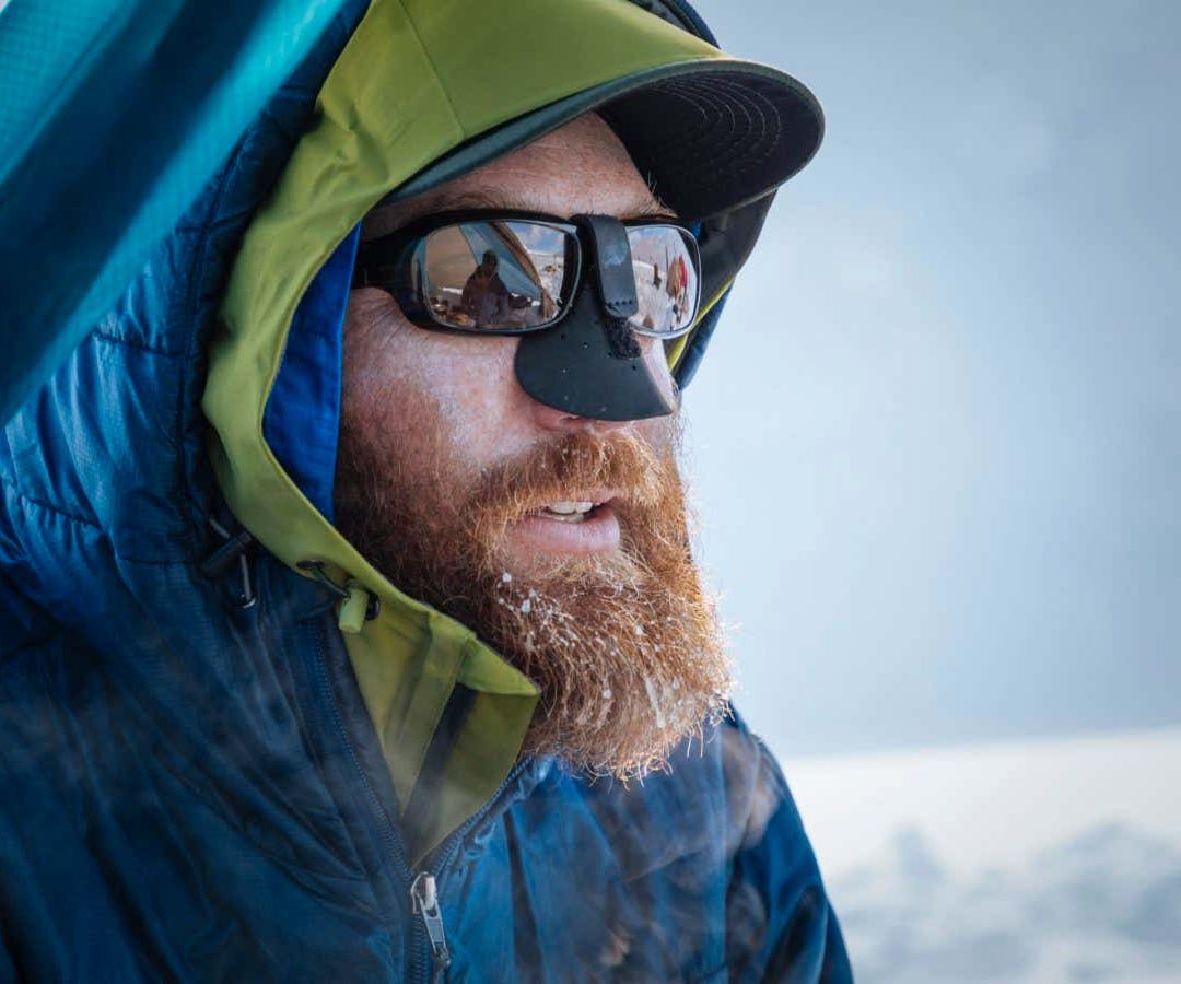 A probiotic cream could make visits to extremely cold environments a little bit saferAurora Photo...