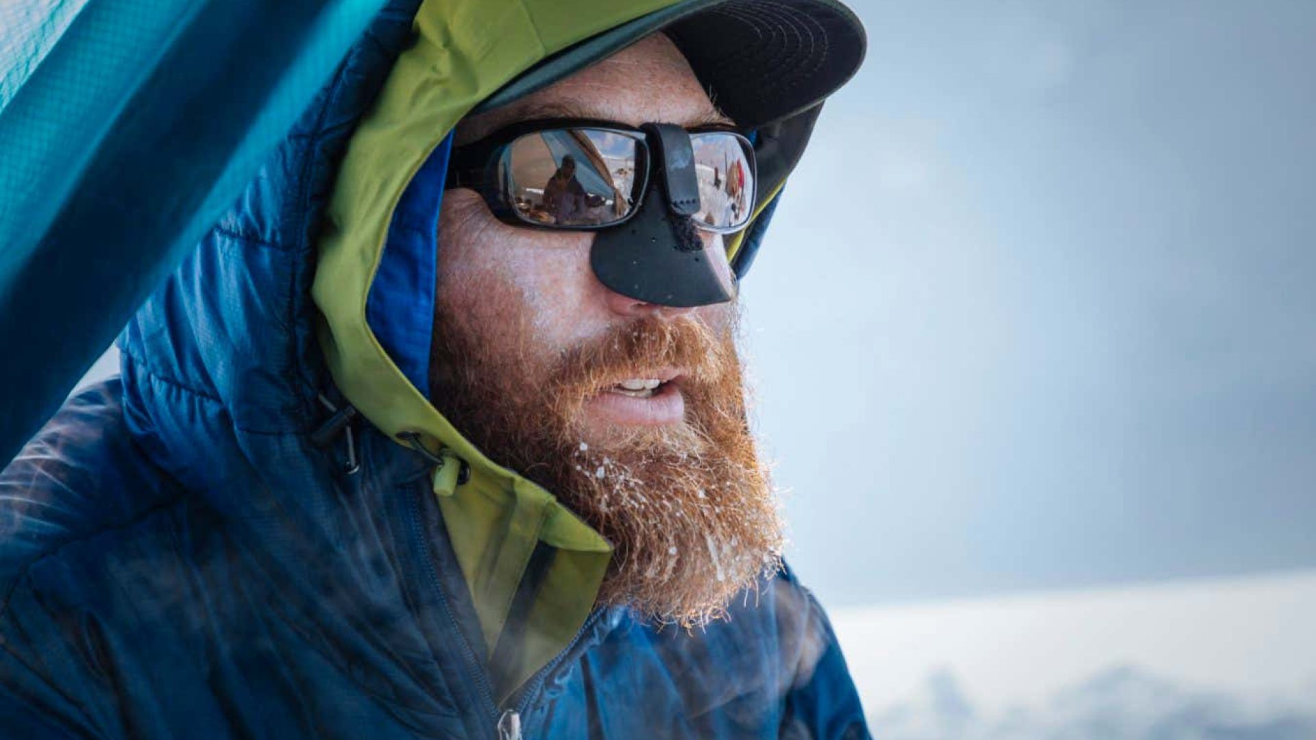 A probiotic cream could make visits to extremely cold environments a little bit saferAurora Photo...